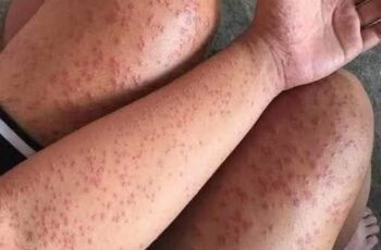 These are the consequences of sleeping with…