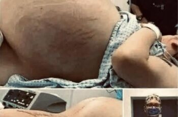 She went into labor, and you won’t believe what they took out of her wo…See more